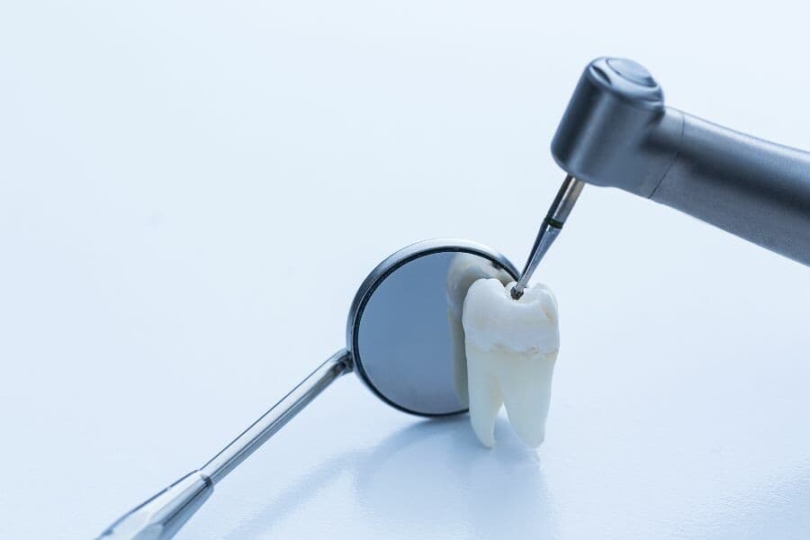 dental implant procedure in Crystal Lake