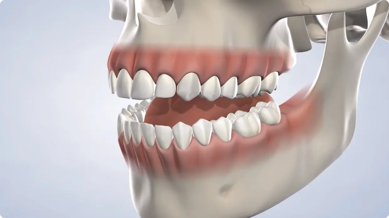 Illustration of skull and set of teeth